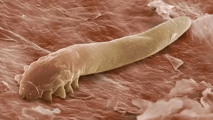 Parasites in the human body